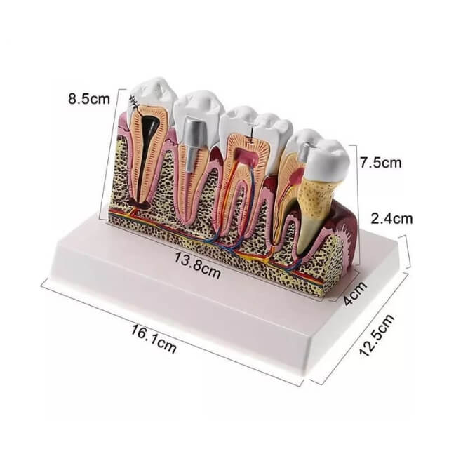 Стандартна стоматологічна модель ортопедичних зубів