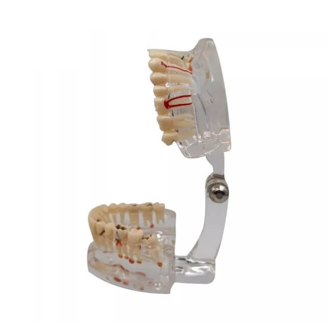 Прозора стоматологічна модель щелепи