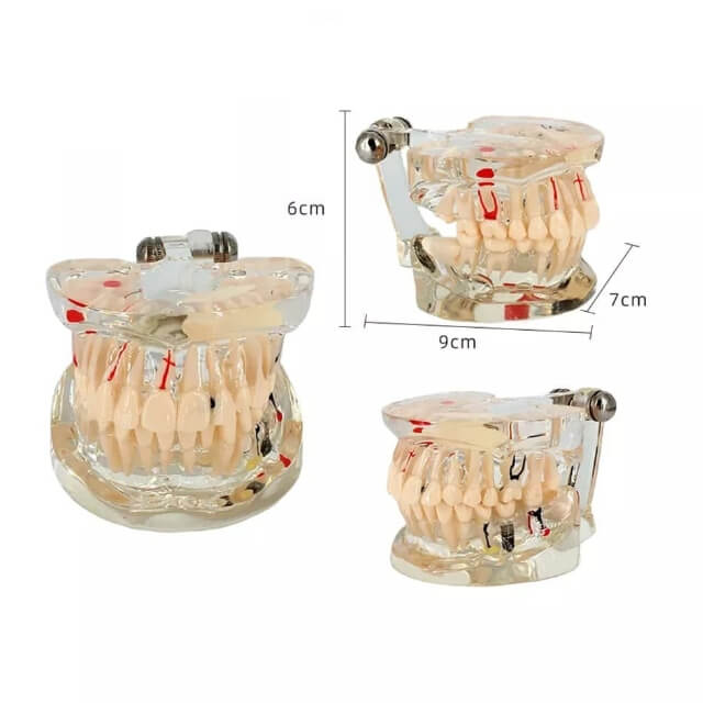 Прозора модель імплантату зуба