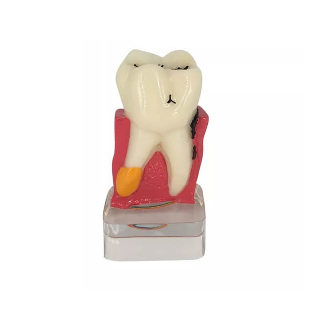 Стоматологічна модель зі смоли