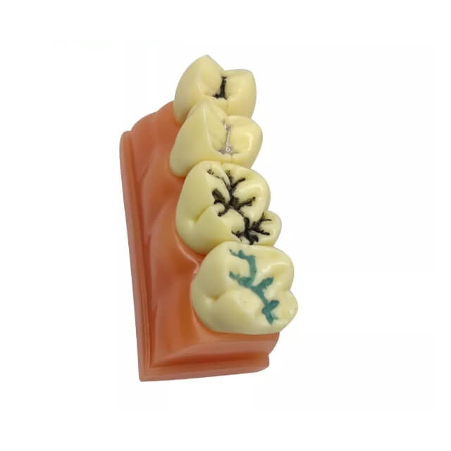 Стоматологічна модель зі смоли