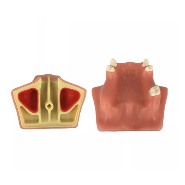 Практична модель імплантату зубів
