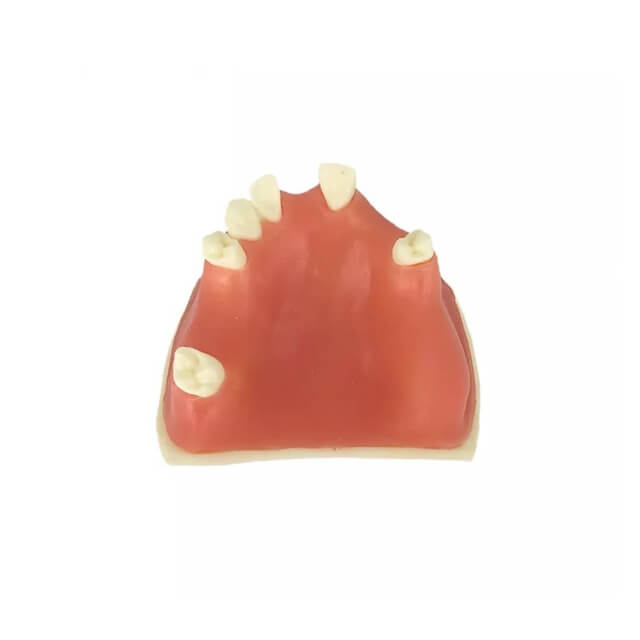 Модель імплантату зуба для студента-стоматолога