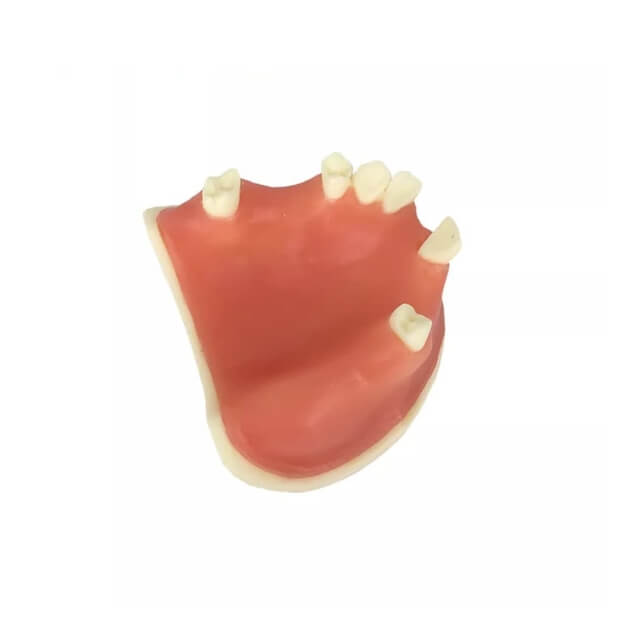 Модель імплантату зуба для студента-стоматолога