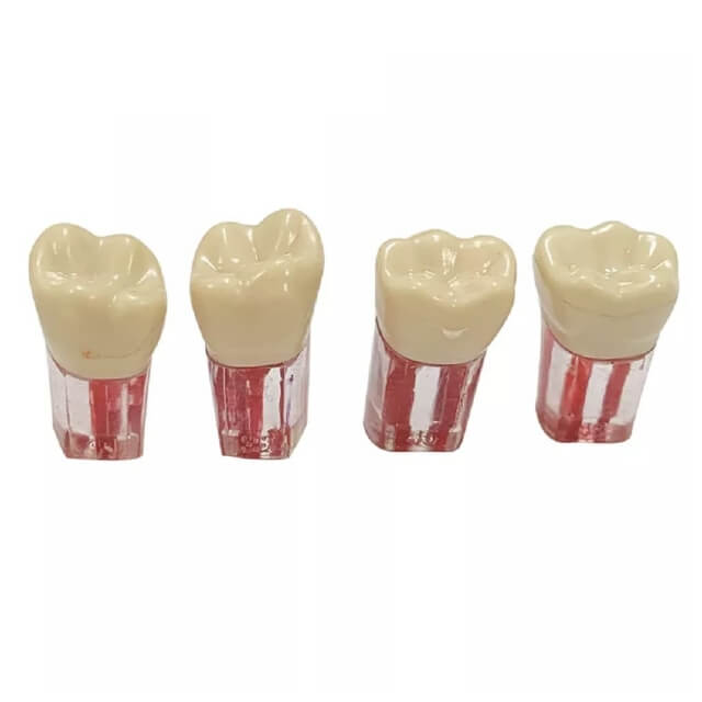 Стоматологічна модель зуба