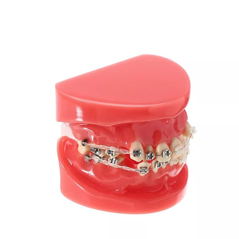 Модель стоматологічного ортодонтичного лікування