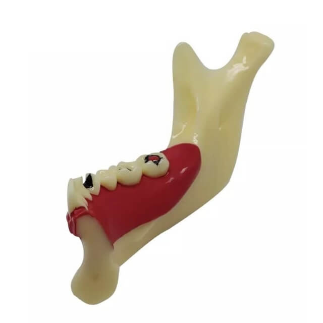 Модель ендодонтичного лікування зубів
